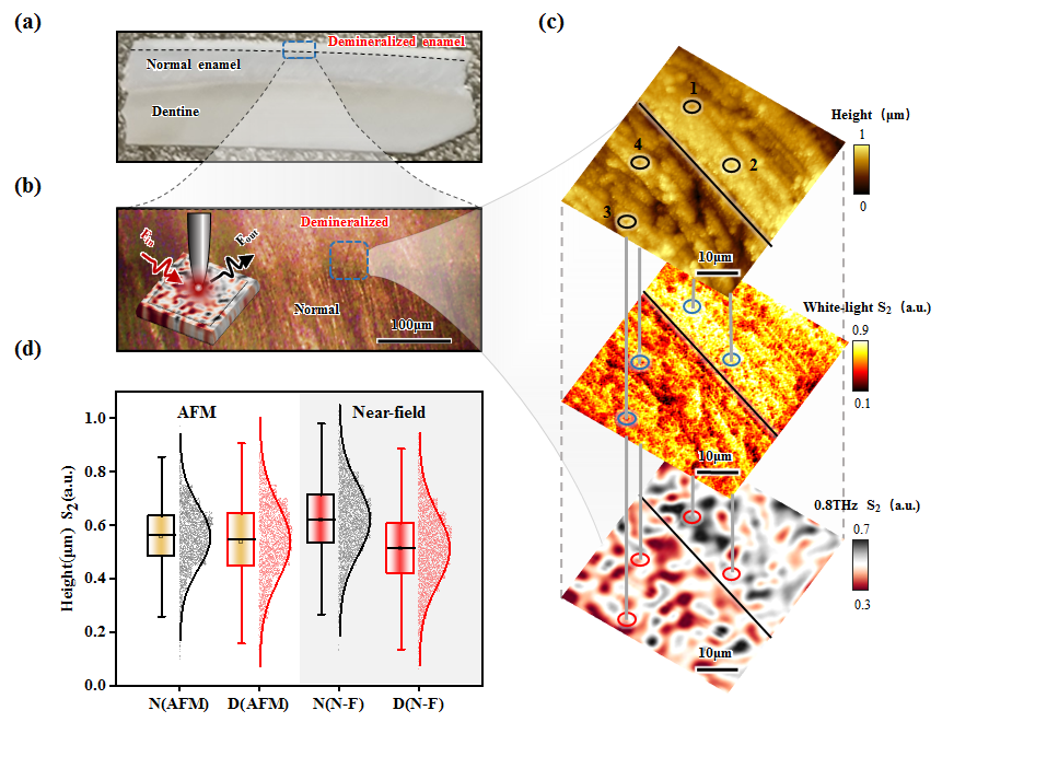 我司携手华西口腔解密牙齿脱矿机制,发表期刊Biomedical Optics Express-成都觅几科技有限公司